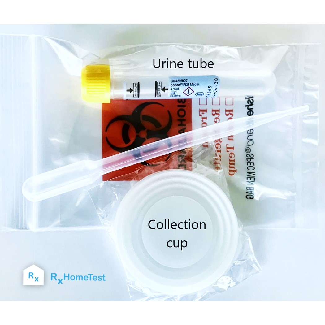 Environmental Pollutants Test image 2