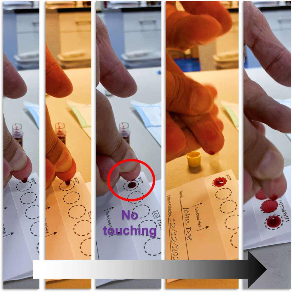 Food Sensitivity - IgG, IgA, IgG4 image 4