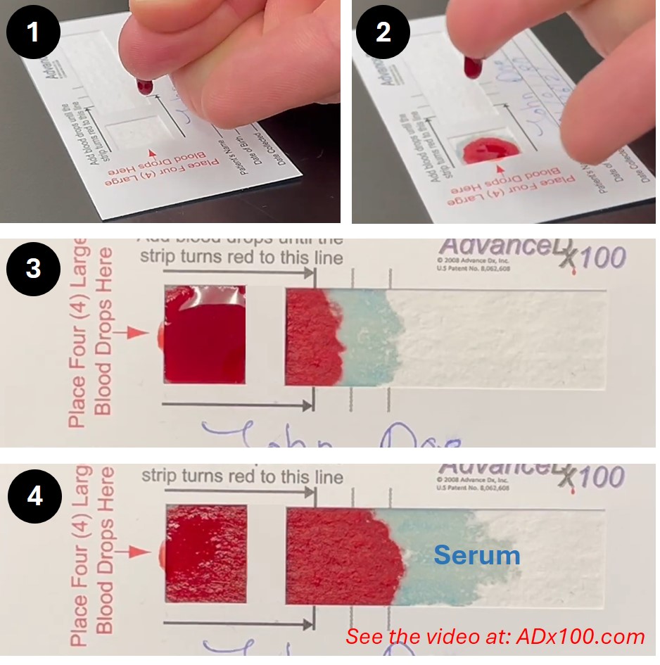 Iron Deficiency Test image 4