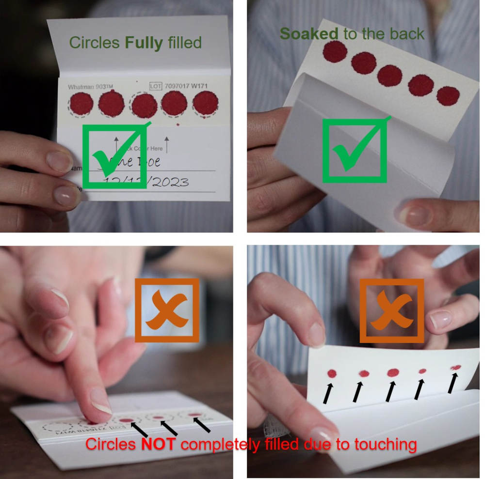 Omega-3 Fatty Acids Test image 5